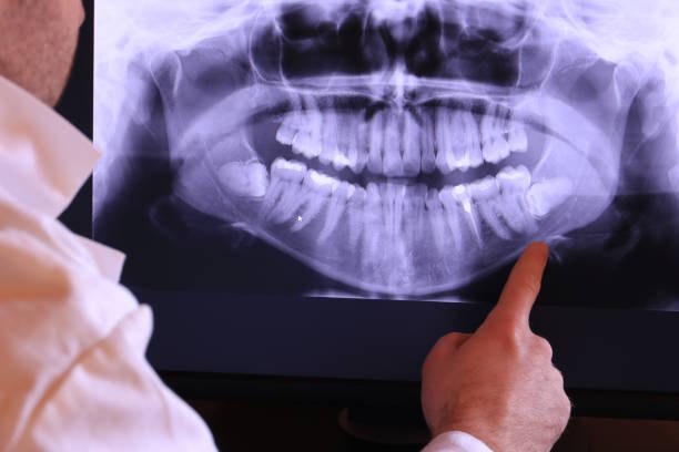 Best Broken Tooth Emergency  in Crandall, TX