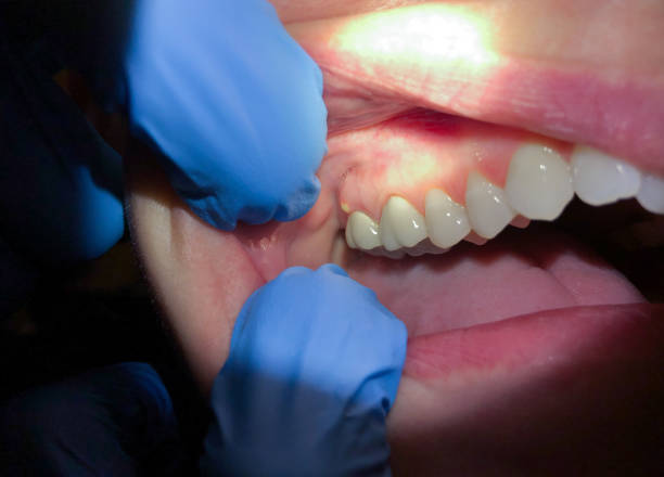 Best Root Canal Emergency Dentist  in Crandall, TX